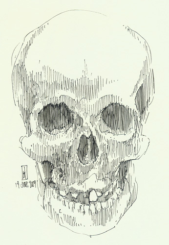 "Skull of Mary Ashberry (Mtter Museum)" is copyright  2009 by James G. Mundie. All rights reserved.  Reproduction prohibited.