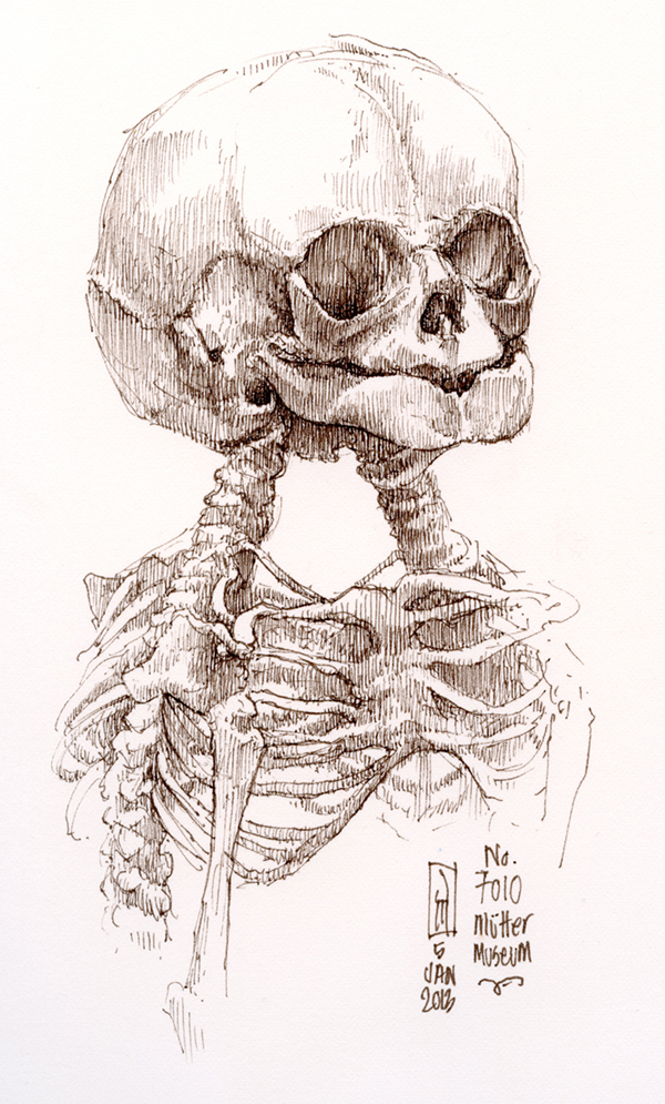 "No. 7010 (Mütter Museum)" is copyright  2013 by James G. Mundie. All rights reserved.  Reproduction prohibited.