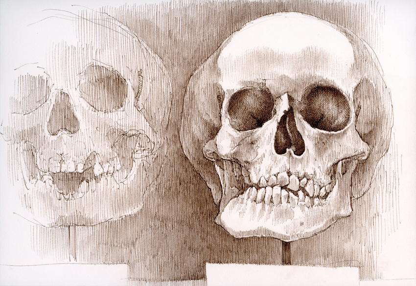 "No. 1006.080 – Czech (Mütter Museum)" is copyright  2013 by James G. Mundie. All rights reserved.  Reproduction prohibited.