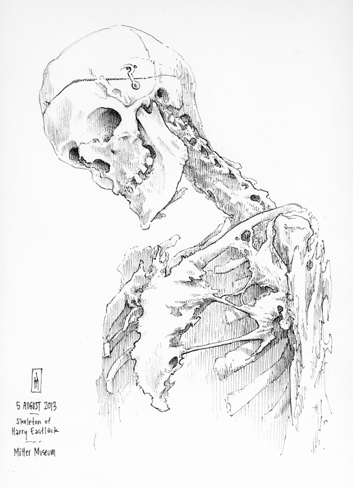 "Harry Eastlack’s remains (Mütter Museum)" is copyright  2013 by James G. Mundie. All rights reserved.  Reproduction prohibited.