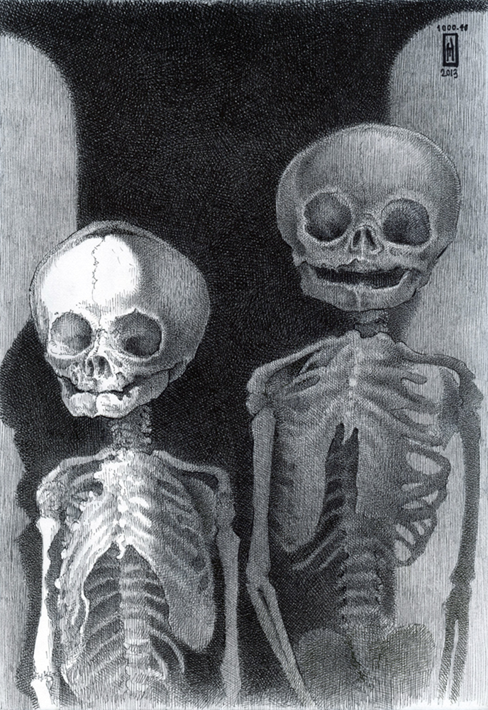 "No. 1000.40 – full term and postpartum (Mütter Museum)" is copyright  2013 by James G. Mundie. All rights reserved.  Reproduction prohibited.