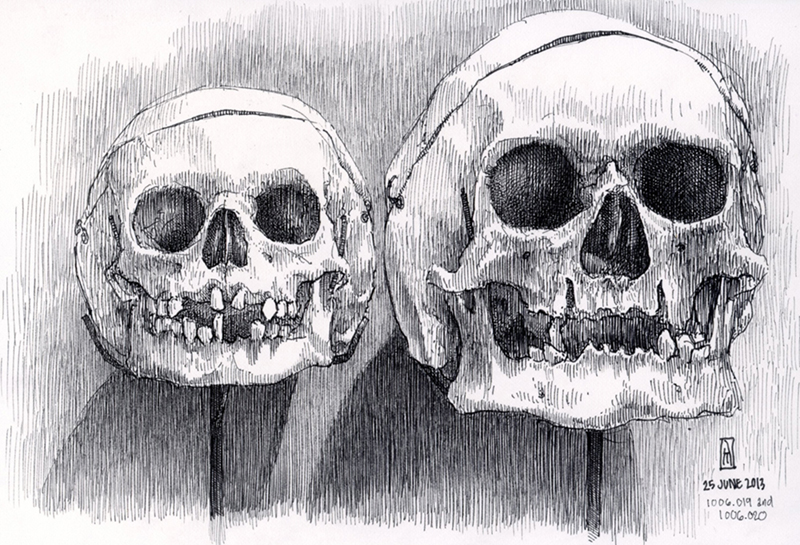 "No. 1006.019 and 1006.020 (Mütter Museum)" is copyright  2013 by James G. Mundie. All rights reserved.  Reproduction prohibited.