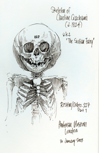 "RCSHM/Osteo. 227 Part 1 (Hunterian Museum)" is copyright  2008 by James G. Mundie. All rights reserved.  Reproduction prohibited.
