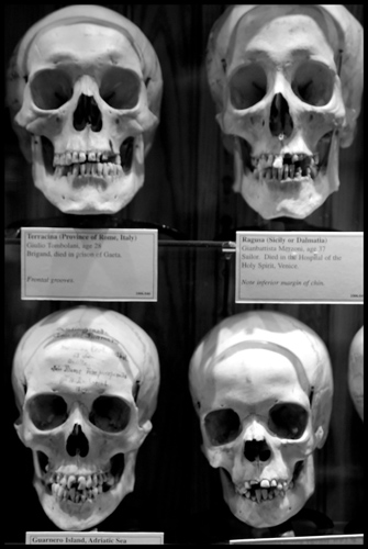 "Hyrtl Skull Collection No. 1d" is copyright  2008 by James G. Mundie. All rights reserved.  Reproduction prohibited.