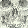 Skull of Mary Ashberry (Mütter Museum)
