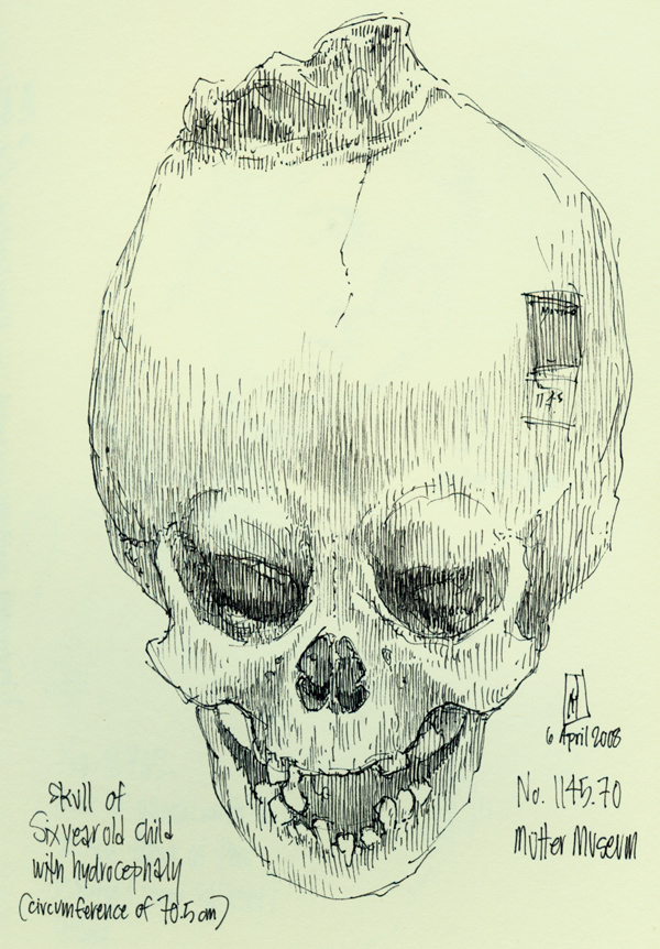 "No. 1145.70 (Mütter Museum)" is copyright © 2008 by James G. Mundie. All rights reserved.  Reproduction prohibited.