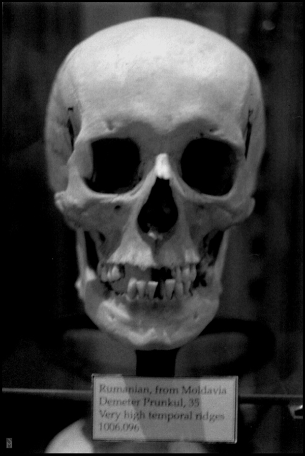 "Rumanian, from Moldavia (Hyrtl Skull Collection)" is copyright © 2008 by James G. Mundie. All rights reserved.  Reproduction prohibited.